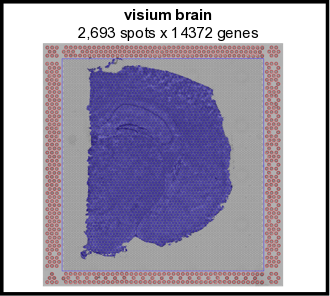 _images/visium_brain_image_summary.png